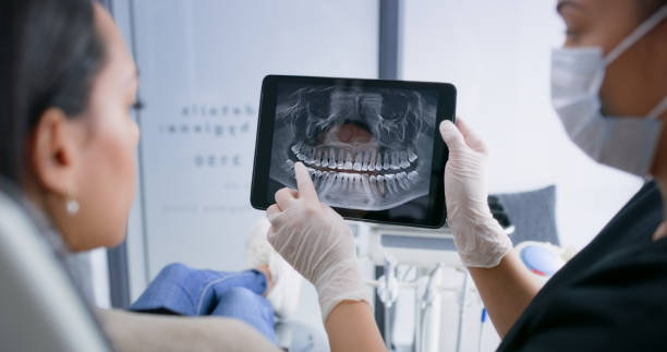 Licensed Tooth Extraction service in Hollywood, SC - Smile Center Dentistry